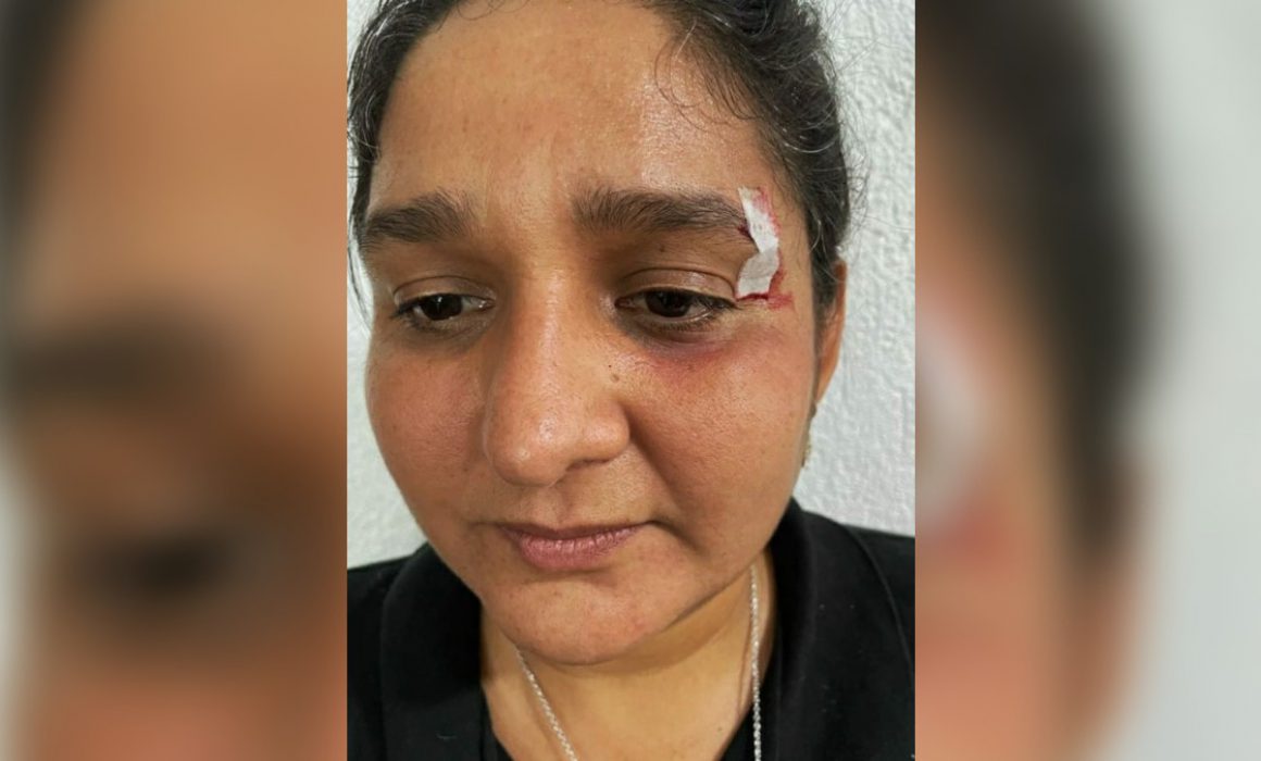 Condena PRI agresión de Morena a líder de mujeres